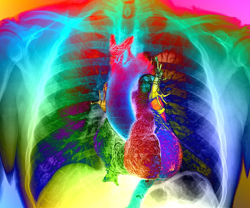 Colorful image of heart inside a skeleton